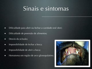 Sinais e sintomas

•   Diﬁculdade para abrir ou fechar a cavidade oral (dor);

•   Diﬁculdade de preensão de alimentos;

•   Desvio da oclusão;

•   Impossibilidade de fechar a boca;

•   Impossibilidade de abrir a boca;

•   Hematoma em região de arco glossopalatino.
 
