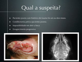 Qual a suspeita?
• Pacientes jovens com histórico de trauma há um ou dois meses.
• Condilectomia prévia (pacientes jovens).
• Impossibilidade em abrir a boca
• Emagrecimento progressivo
 