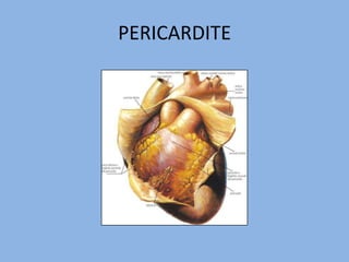 PERICARDITE
 