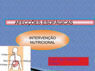 AFECÇÕES ESOFÁGICAS
INTERVENÇÃO
NUTRICIONAL
Profa. Msc. Betânia
Freitas
 