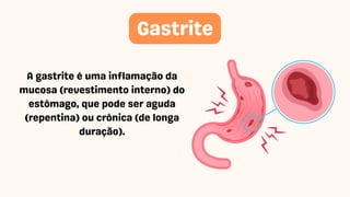 A gastrite é uma inflamação da
mucosa (revestimento interno) do
estômago, que pode ser aguda
(repentina) ou crônica (de longa
duração).
Gastrite
 
