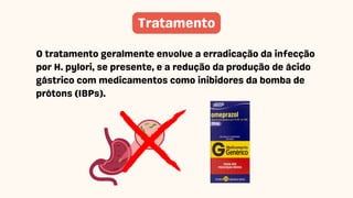 O tratamento geralmente envolve a erradicação da infecção
por H. pylori, se presente, e a redução da produção de ácido
gástrico com medicamentos como inibidores da bomba de
prótons (IBPs).
Tratamento
 