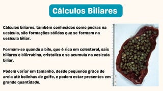 Cálculos biliares, também conhecidos como pedras na
vesícula, são formações sólidas que se formam na
vesícula biliar.
Formam-se quando a bile, que é rica em colesterol, sais
biliares e bilirrubina, cristaliza e se acumula na vesícula
biliar.
Podem variar em tamanho, desde pequenos grãos de
areia até bolinhas de golfe, e podem estar presentes em
grande quantidade.
Cálculos Biliares
 