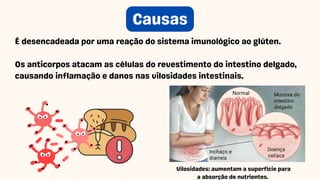 Causas
É desencadeada por uma reação do sistema imunológico ao glúten.
Os anticorpos atacam as células do revestimento do intestino delgado,
causando inflamação e danos nas vilosidades intestinais.
Vilosidades: aumentam a superfície para
a absorção de nutrientes.
 