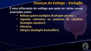 Doenças do Esôfago – Esofagite
É uma inflamação do esôfago que pode ter várias causas
associadas como:
• Refluxo gastro esofágico (Esofagite péptica1
);
• Ingestão voluntária ou acidental de cáusticos
(Esofagite cáustica2
);
• Infeciosa;
• Alérgica (Esofagite Eosinofilia3
).
 