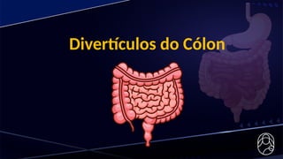 Divertículos do Cólon
 