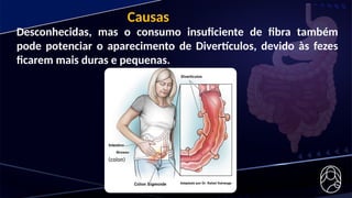 Desconhecidas, mas o consumo insuficiente de fibra também
pode potenciar o aparecimento de Divertículos, devido às fezes
ficarem mais duras e pequenas.
Causas
 