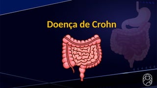Doença de Crohn
 