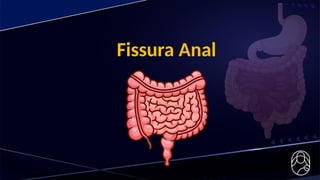 Fissura Anal
 