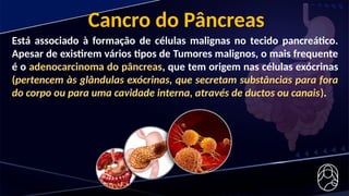 Cancro do Pâncreas
Está associado à formação de células malignas no tecido pancreático.
Apesar de existirem vários tipos de Tumores malignos, o mais frequente
é o adenocarcinoma do pâncreas, que tem origem nas células exócrinas
(pertencem às glândulas exócrinas, que secretam substâncias para fora
do corpo ou para uma cavidade interna, através de ductos ou canais).
 