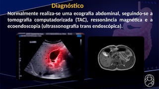 Normalmente realiza-se uma ecografia abdominal, seguindo-se a
tomografia computadorizada (TAC), ressonância magnética e a
ecoendoscopia (ultrassonografia trans endoscópica).
Diagnóstico
 
