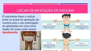 LOCAIS DE APLICAÇÃO DE INSULINA
É importante fazer o rodízio
entre os locais de aplicação da
insulina pois o uso prolongado
de aplicações em uma única
região do corpo pode causar
lipodistrofia.
 