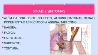 SINAIS E SINTOMAS
•ALÉM DA DOR FORTE NO PEITO, ALGUNS SINTOMAS GERAIS
PODEM ESTAR ASSOCIADOS A ANGINA, TAIS COMO:
•NÁUSEA;
•FADIGA;
•FALTA DE AR;
•SUDORESE;
•TONTURA.
 