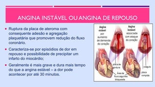 ANGINA INSTÁVEL OU ANGINA DE REPOUSO
 Ruptura da placa de ateroma com
consequente adesão e agregação
plaquetária que promovem redução do fluxo
coronário.
 Caracteriza-se por episódios de dor em
repouso e possibilidade de precipitar um
infarto do miocárdio;
 Geralmente é mais grave e dura mais tempo
do que a angina estável – a dor pode
acontecer por até 30 minutos.
 