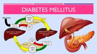 DIABETES MELLITUS
 