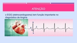 ATENÇÃO
o EGG (eletrocardiograma) tem função importante no
diagnóstico de Angina
P
Q
R
S
T
 