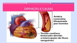 DEFINIÇÃO E CAUSAS
 