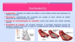 TRATAMENTO
 Angioplastia: utilização de cateter com balão ou rede metálica (stent) para desentupir as
artérias coronárias.
 Aterectomia: desobstrução das coronárias por sucção ou laser, através de cateter
introduzido em artéria de braço ou perna.
 Cirurgia de revascularização do miocárdio: ponte (veia safena e/ou artéria mamária
interna).
 Transplante de coração: nas cirurgias cardíacas, a circulação sanguínea precisa ser
isolada do coração. Para isso, é usado um coração-pulmão artificial, também chamado de
circulação extracorpórea.
 