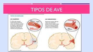 TIPOS DE AVE
 