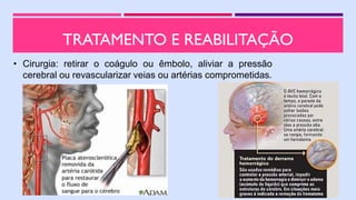 TRATAMENTO E REABILITAÇÃO
• Cirurgia: retirar o coágulo ou êmbolo, aliviar a pressão
cerebral ou revascularizar veias ou artérias comprometidas.
 