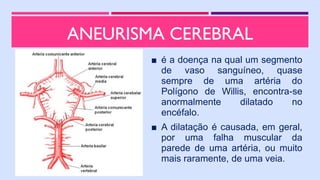 ■ é a doença na qual um segmento
de vaso sanguíneo, quase
sempre de uma artéria do
Polígono de Willis, encontra-se
anormalmente dilatado no
encéfalo.
■ A dilatação é causada, em geral,
por uma falha muscular da
parede de uma artéria, ou muito
mais raramente, de uma veia.
ANEURISMA CEREBRAL
 