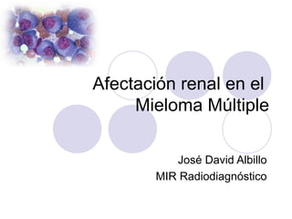 Afectación renal en el
Mieloma Múltiple
José David Albillo
MIR Radiodiagnóstico
 