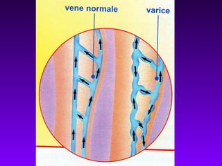 Afectiunile sistemului circulator