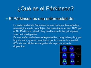 ¿Qué es el Párkinson? El Párkinson es una enfermedad de La enfermedad de Parkinson es una de las enfermedades neurológicas más complejas, fue descrita en el año 1870 por el Dr. Parkinson, siendo hoy en día una de las principales vías de investigación.  Es una enfermedad neurodegenerativa, progresiva y hoy por hoy sin cura, que se caracteriza por la muerte de más del 80% de las células encargadas de la producción de dopamina. 