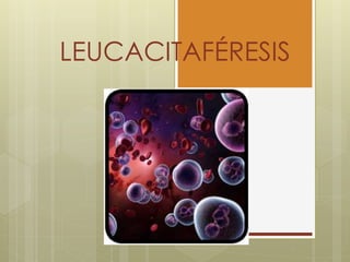 LEUCACITAFÉRESIS
 