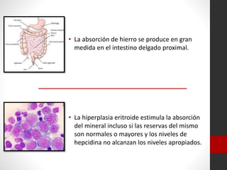 • La absorción de hierro se produce en gran
medida en el intestino delgado proximal.

• La hiperplasia eritroide estimula la absorción
del mineral incluso si las reservas del mismo
son normales o mayores y los niveles de
hepcidina no alcanzan los niveles apropiados.

 