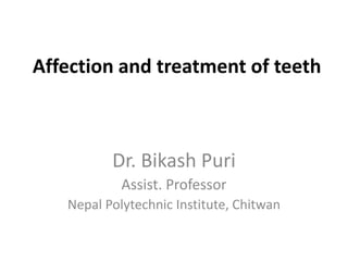 Affection and treatment of teeth
Dr. Bikash Puri
Assist. Professor
Nepal Polytechnic Institute, Chitwan
 