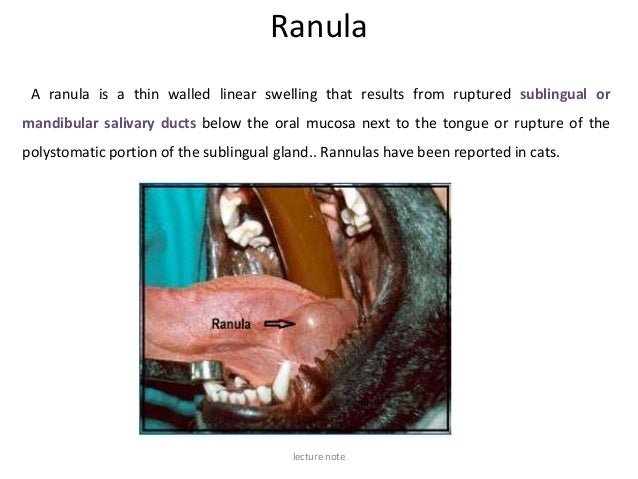 Affection Of Salivary Gland