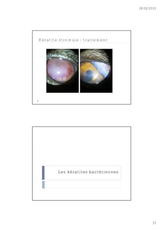28/02/2010




Kératite stromale : traitement




        Les kératites bactériennes




                                            33
 