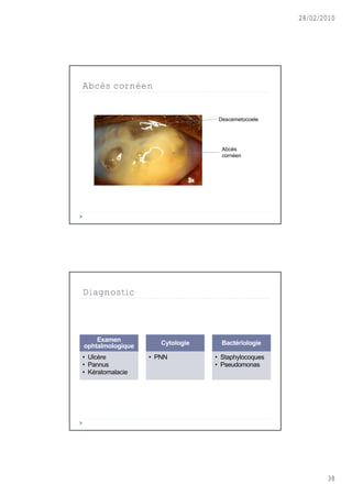 28/02/2010




Abcès cornéen


                                  Descemetocoele




                                   Abc•s
                                   corn‚en




Diagnostic



    Examen           Cytologie     Bactériologie
ophtalmologique
• Ulc•re          • PNN          • Staphylocoques
• Pannus                         • Pseudomonas
• K‚ratomalacie




                                                           38
 