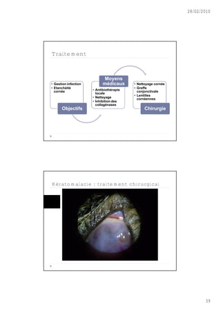 28/02/2010




Traitement



                             Moyens
• Gestion infection         médicaux      • Nettoyage cornée
• Etanchéité                              • Greffe
  cornée              • Antibiothérapie     conjonctivale
                        locale
                                          • Lentilles
                      • Nettoyage           cornéennes
                      • Inhibition des
                        collagénases
      Objectifs                                 Chirurgie




Kératomalacie : traitement chirurgical




                                                                      39
 