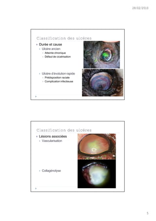28/02/2010




Classification des ulcères
   Dur‚e et cause
       Ulc•re ancien
           Atteinte chronique
           D‚faut de cicatrisation




       Ulc•re d’‚volution rapide
           Pr‚disposition raciale
           Complication infectieuse




Classification des ulcères
   L‚sions associ‚es
       Vascularisation




       Collag‚nolyse




                                               5
 