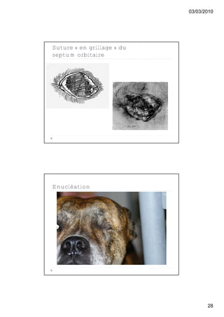 03/03/2010




Suture « en grillage » du
septum orbitaire




Enucléation




                                   28
 
