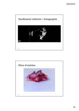 03/03/2010




Gonflement orbitaire : €chographie




Pi‚ce d’ex€r‚se




                                            30
 