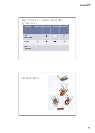 03/03/2010




Enucléation : comparaison des
techniques
 Technique       Saignement Ex. orbite   R. septique Ex. sclère




 Trans-              -           0          +++          ++
 conjonctivale

 Latérale            -           +           ++           +

 Trans-             ++          ++            -           -
 Palpébrale




Exentération




                                                                         32
 