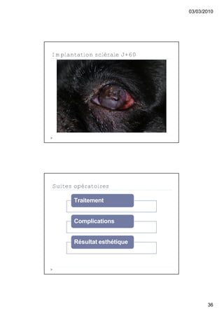 03/03/2010




Implantation sclérale J+60




Suites opératoires

      Traitement


      Complications


      Résultat esthétique




                                    36
 