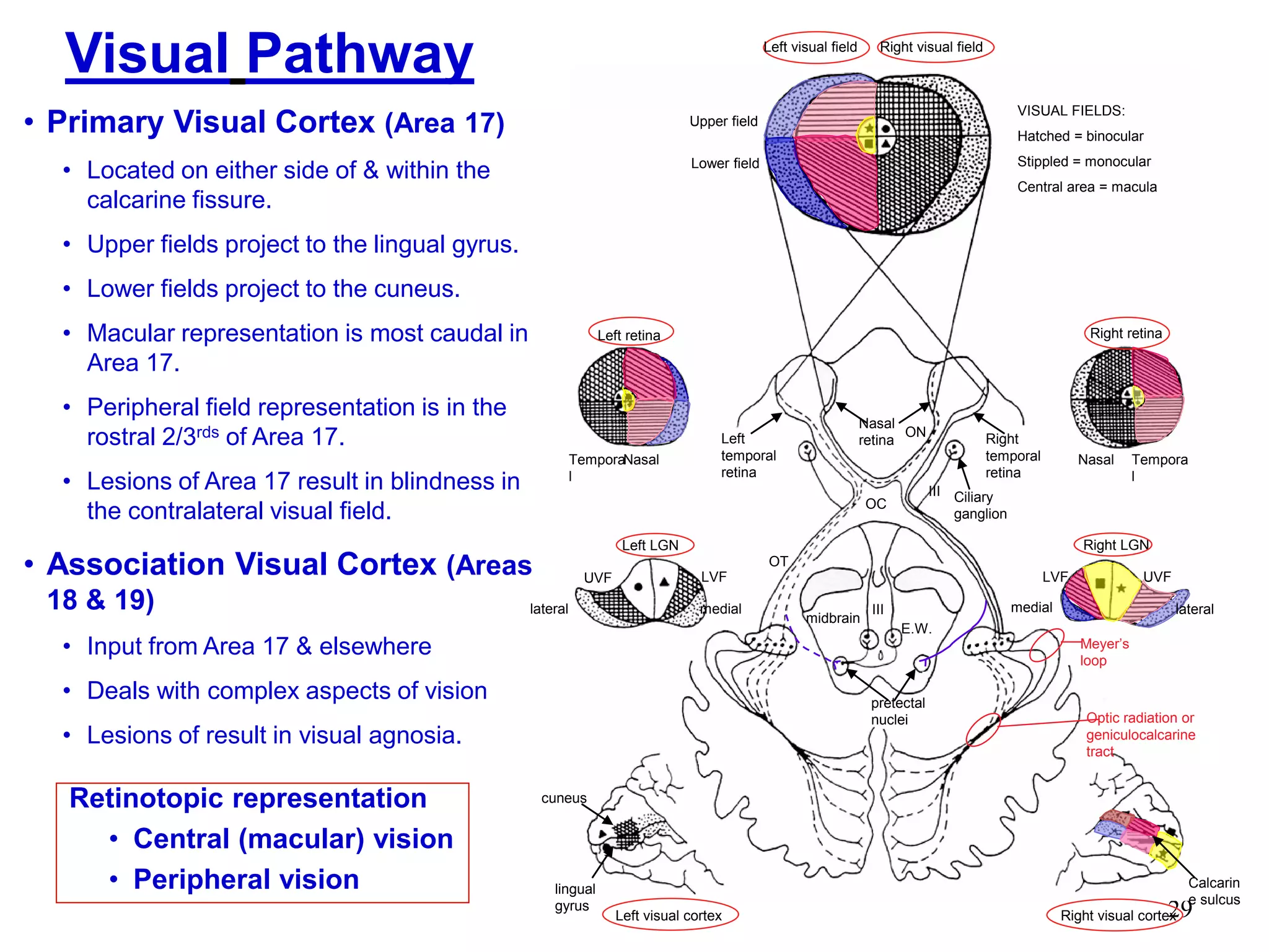 29
Visual Pathway
Retinotopic representation
• Central (macular) vision
• Peripheral vision
Left visual field Right visual field
Right retinaLeft retina
Left LGN
Tempora
l
Nasal Tempora
l
Nasal
lateral lateralmedial medial
LVFLVF UVFUVF
E.W.
Right visual cortex
midbrain
Right LGN
Left visual cortex
Left
temporal
retina
Right
temporal
retina
Nasal
retina
Ciliary
ganglion
pretectal
nuclei
cuneus
lingual
gyrus
Calcarin
e sulcus
III
III
Meyer‟s
loop
Optic radiation or
geniculocalcarine
tract
Upper field
Lower field
VISUAL FIELDS:
Hatched = binocular
Stippled = monocular
Central area = macula
ON
OC
OT
• Primary Visual Cortex (Area 17)
• Located on either side of & within the
calcarine fissure.
• Upper fields project to the lingual gyrus.
• Lower fields project to the cuneus.
• Macular representation is most caudal in
Area 17.
• Peripheral field representation is in the
rostral 2/3rds of Area 17.
• Lesions of Area 17 result in blindness in
the contralateral visual field.
• Association Visual Cortex (Areas
18 & 19)
• Input from Area 17 & elsewhere
• Deals with complex aspects of vision
• Lesions of result in visual agnosia.
 
