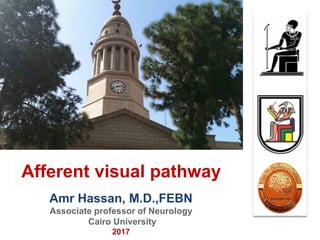 Amr Hassan, M.D.,FEBN
Associate professor of Neurology
Cairo University
2017
Afferent visual pathway
 