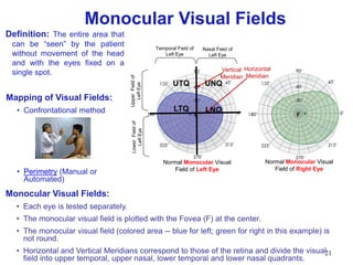 21
Definition: The entire area that
can be “seen” by the patient
without movement of the head
and with the eyes fixed on a
single spot.
Monocular Visual Fields
Mapping of Visual Fields:
• Confrontational method
• Perimetry (Manual or
Automated)
Temporal Field of
Left Eye
Nasal Field of
Left Eye
F
Normal Monocular Visual
Field of Right Eye
Normal Monocular Visual
Field of Left Eye
F
Monocular Visual Fields:
• Each eye is tested separately.
• The monocular visual field is plotted with the Fovea (F) at the center.
• The monocular visual field (colored area -- blue for left; green for right in this example) is
not round.
• Horizontal and Vertical Meridians correspond to those of the retina and divide the visual
field into upper temporal, upper nasal, lower temporal and lower nasal quadrants.
Vertical
Meridian
Horizontal
Meridian
UpperFieldof
LeftEye
LowerFieldof
LeftEye
UTQ
LTQ
UNQ
LNQ
 