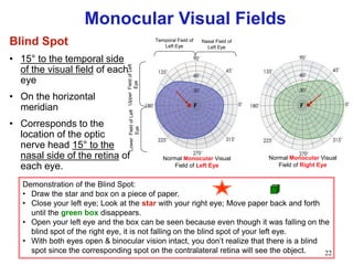 22
Blind Spot
• 15° to the temporal side
of the visual field of each
eye
• On the horizontal
meridian
• Corresponds to the
location of the optic
nerve head 15° to the
nasal side of the retina of
each eye.
Demonstration of the Blind Spot:
• Draw the star and box on a piece of paper.
• Close your left eye; Look at the star with your right eye; Move paper back and forth
until the green box disappears.
• Open your left eye and the box can be seen because even though it was falling on the
blind spot of the right eye, it is not falling on the blind spot of your left eye.
• With both eyes open & binocular vision intact, you don‟t realize that there is a blind
spot since the corresponding spot on the contralateral retina will see the object.
Temporal Field of
Left Eye
Nasal Field of
Left Eye
Normal Monocular Visual
Field of Left Eye
F F
Normal Monocular Visual
Field of Right Eye
UpperFieldofLeft
Eye
LowerFieldofLeft
Eye
Monocular Visual Fields
 