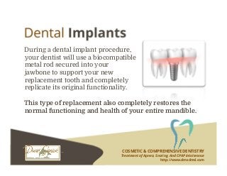 COSMETIC & COMPREHENSIVE DENTISTRY
Treatment of Apnea, Snoring, And CPAP Intolerance
http://www.dmsdmd.com
During a dental implant procedure,
your dentist will use a biocompatible
metal rod secured into your
jawbone to support your new
replacement tooth and completely
replicate its original functionality.
This type of replacement also completely restores the
normal functioning and health of your entire mandible.
 