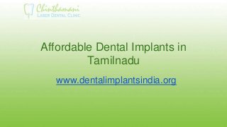 Affordable Dental Implants in
Tamilnadu
www.dentalimplantsindia.org
 