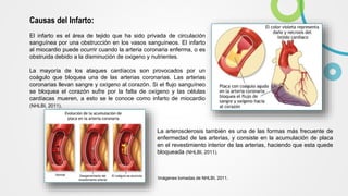 Causas del Infarto:
El infarto es el área de tejido que ha sido privada de circulación
sanguínea por una obstrucción en los vasos sanguíneos. El infarto
al miocardio puede ocurrir cuando la arteria coronaria enferma, o es
obstruida debido a la disminución de oxigeno y nutrientes.
La mayoría de los ataques cardíacos son provocados por un
coágulo que bloquea una de las arterias coronarias. Las arterias
coronarias llevan sangre y oxígeno al corazón. Si el flujo sanguíneo
se bloquea el corazón sufre por la falta de oxígeno y las células
cardíacas mueren, a esto se le conoce como infarto de miocardio
(NHLBI, 2011).
Imágenes tomadas de NHLBI, 2011.
La arterosclerosis también es una de las formas más frecuente de
enfermedad de las arterias, y consiste en la acumulación de placa
en el revestimiento interior de las arterias, haciendo que esta quede
bloqueada (NHLBI, 2011).
 