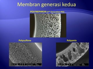Afiatin high perfomance renal replacement therapy ppt | PPTX