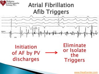 Atrial Fibrillation - From Diagnosis to Treatment - St Vincent's ...