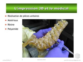 Décembre 20153
L'impression 3D et le médicalL'impression 3D et le médical
Réalisation de pièces unitaires
Matériaux
Résine
Polyamide
 